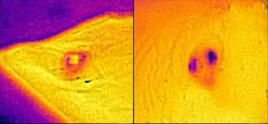 Device Comparison: High-Energy Surgery vs. Low-Energy Deposition